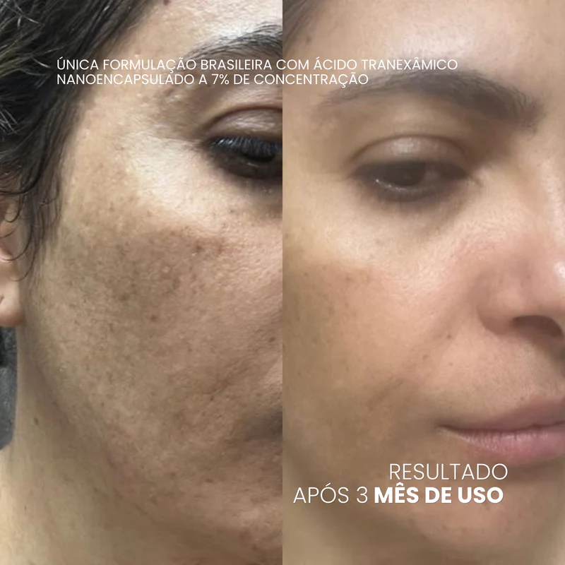 Antes e depois — Regina
