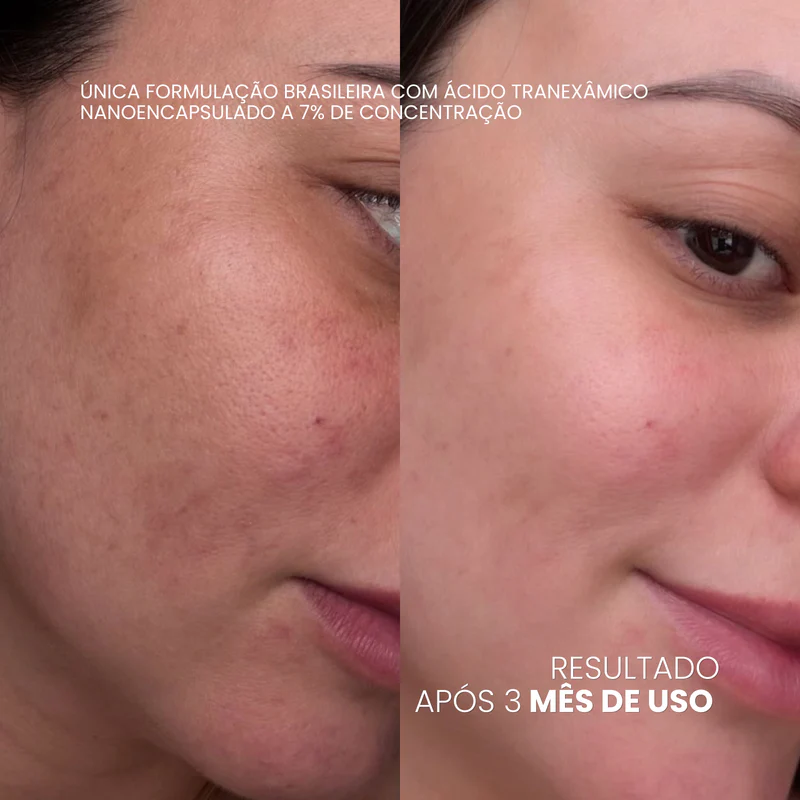 Antes e depois — Cláudia